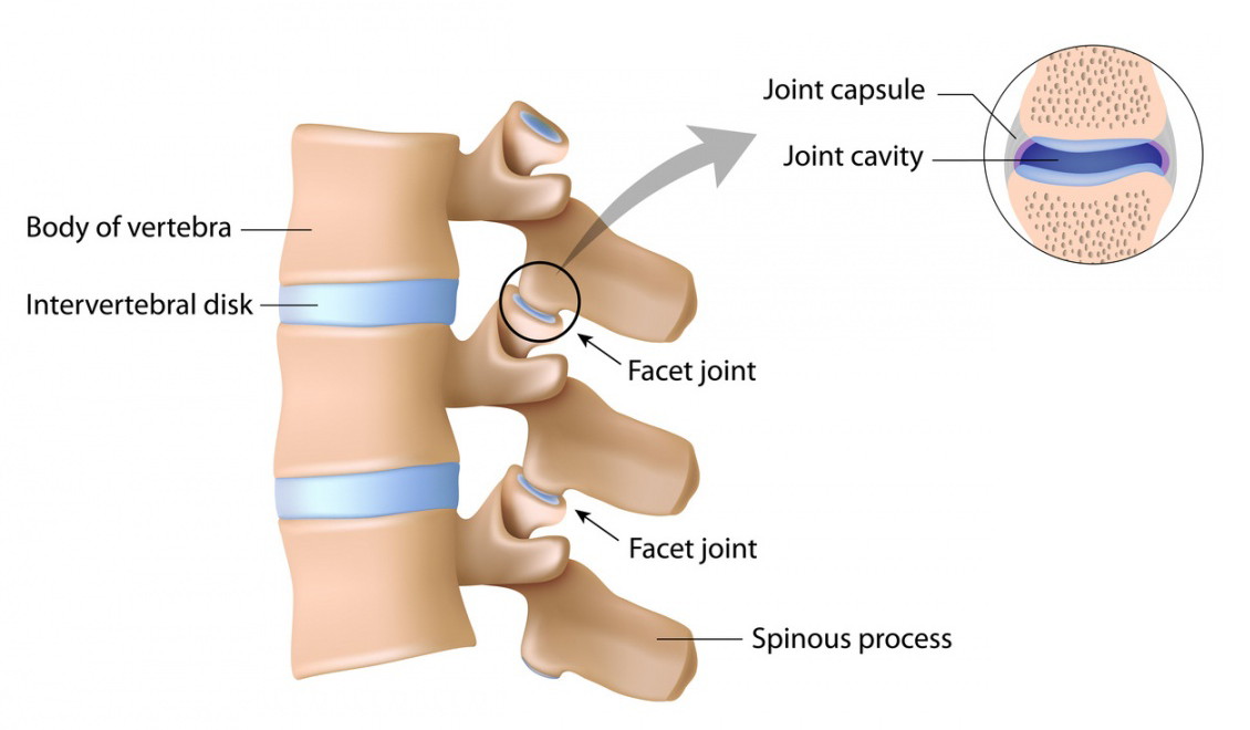 Facet joint