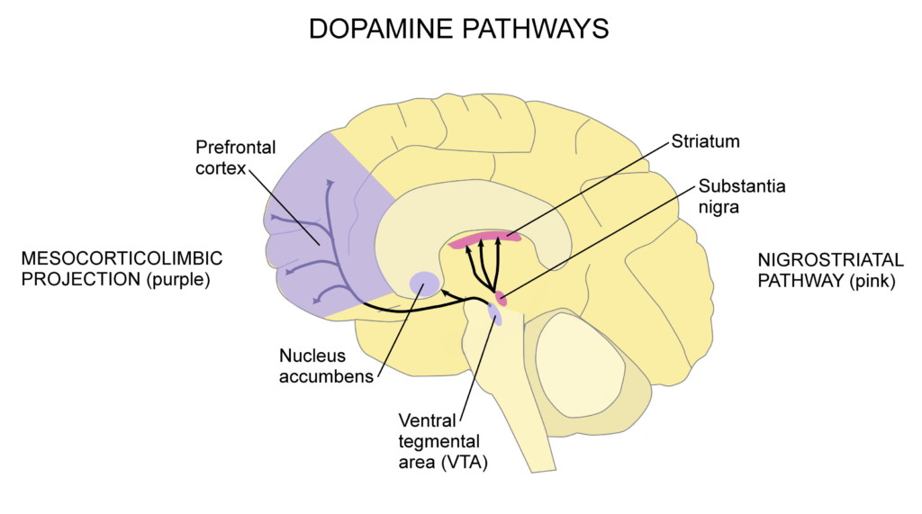 Parkinson's disease