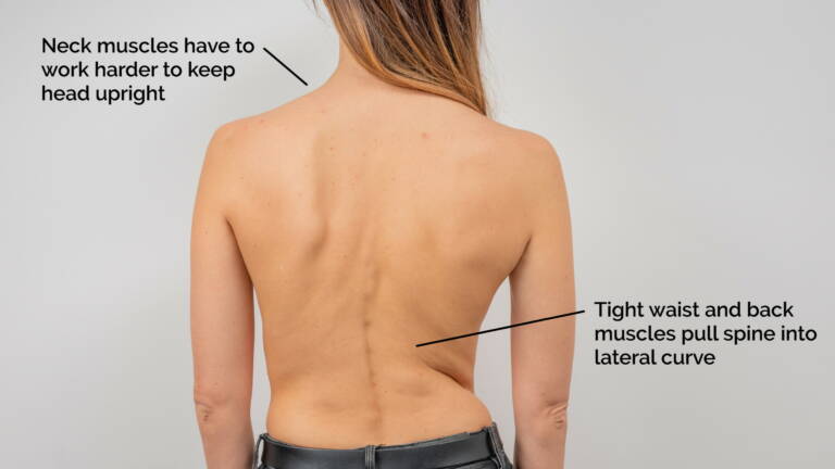 Relieve Neck & Shoulder Tension with Pandiculation